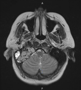 MRI 1