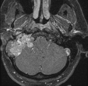 MRI 2