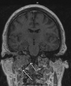 MRI 4