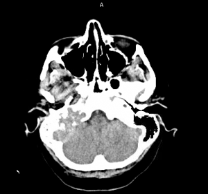 MRI 6
